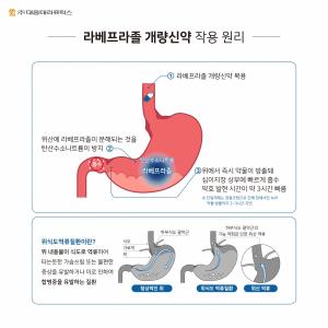 대웅테라퓨틱스, 위식도역류질환 ‘라베프라졸 개량신약’ 발매